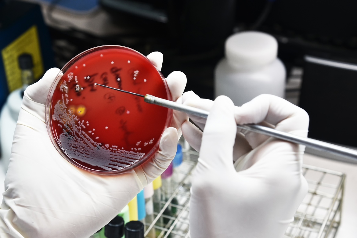 A medical technician wearing gloves is working on bacteria culture and drug resistance of pathogens in a laboratory